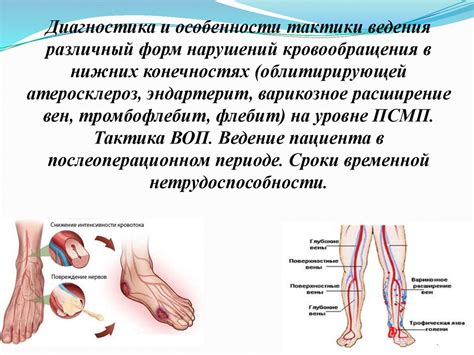 Диагностика: методы обнаружения нарушений кровообращения