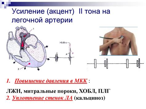 Диагностика акцента 2-го тона над аортой