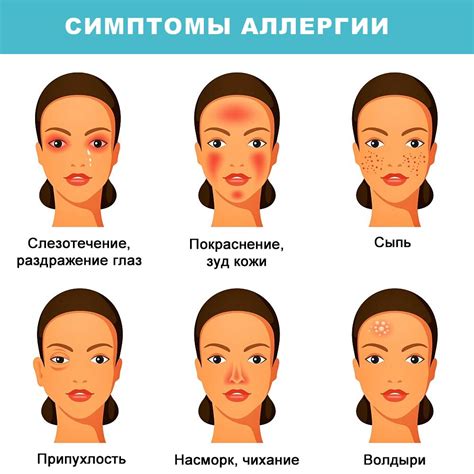 Диагностика аллергии и чесотки: симптомы и методы определения