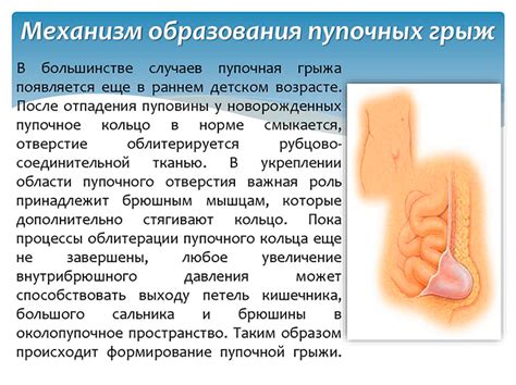 Диагностика грыжи пупка у мужчин