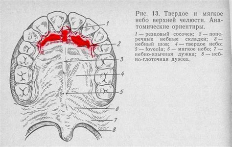 Диагностика и лечение воспаления верхнего неба