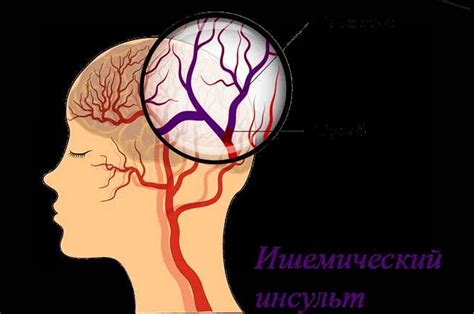 Диагностика и лечение проблем с кровообращением в шейной области