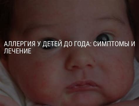 Диагностика лопоухости у детей до года