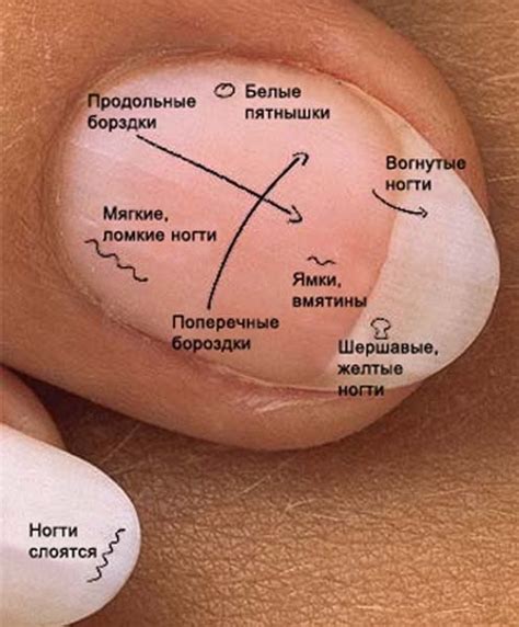 Диагностика проблем с основой для ногтей