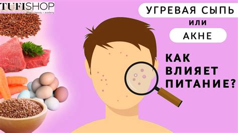 Диета и питание для предотвращения прыщей на десне