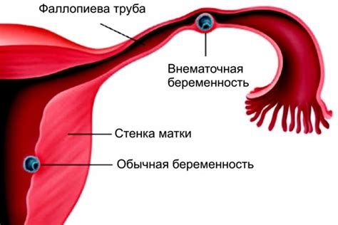 Длительная беременность: причины и значение