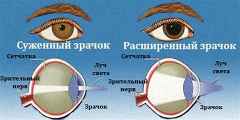 Другая структура зрачков