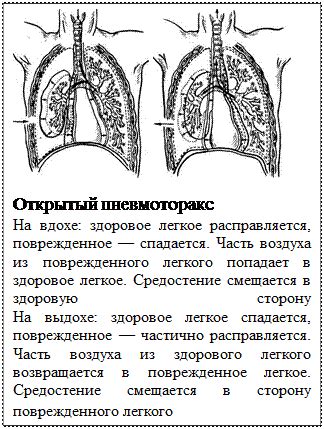 Дыхание при пневмотораксе: какое оно?