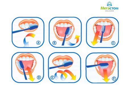 Ежедневное проведение гигиены ротовой полости