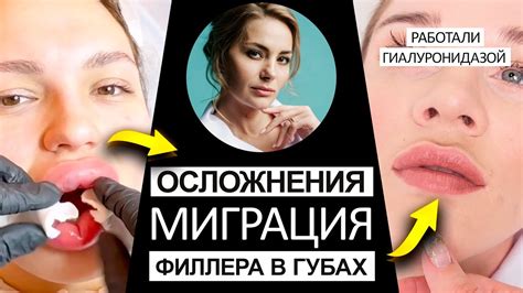 Естественные методы для создания объема в губах