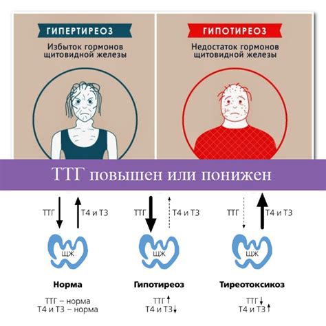 Жизненный стиль и норма щитовидной железы