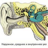 Заболевания вестибулярного аппарата и шум