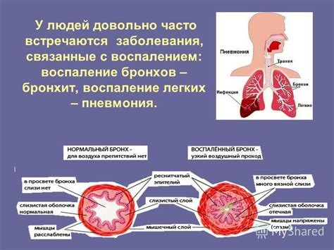 Заболевания дыхательной системы, вызывающие одышку