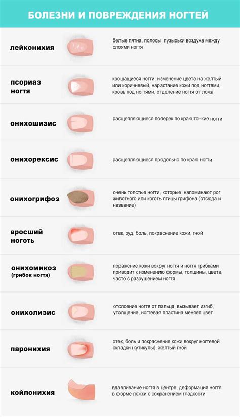 Заболевания и инфекции, влияющие на рост ногтей