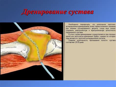 Заболевания костей и суставов: