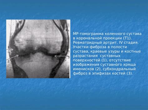 Заболевания костно-суставной системы