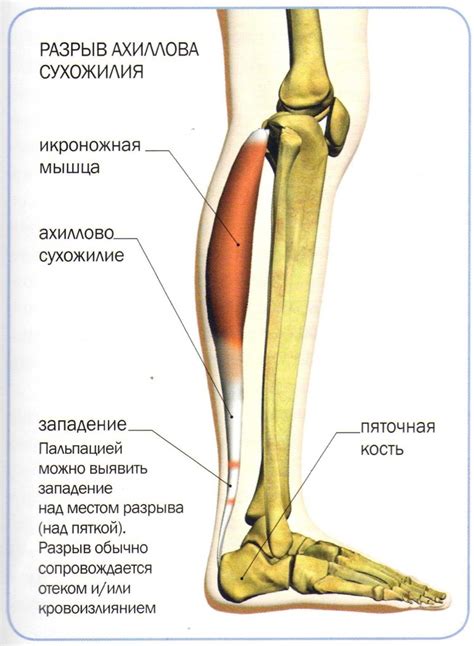 Заболевания мышц передней лапы