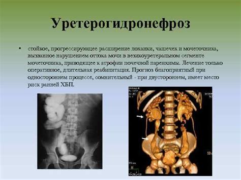 Заболевания органов мочеполовой системы, приводящие к воспалению лимфоузлов в паху у детей