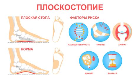 Заболевания пальцев на левой ноге, которые могут вызвать боль