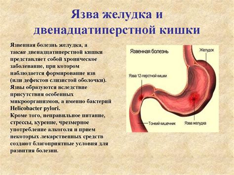 Заболевания пищеварительной системы, вызывающие коричневую рвоту