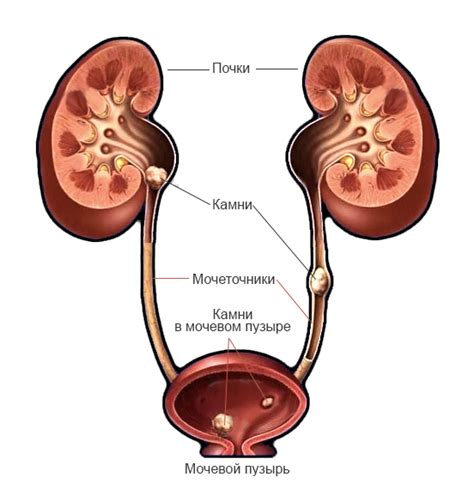 Заболевания почек и мочевого пузыря