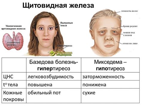 Заболевания щитовидной железы и возможные последствия