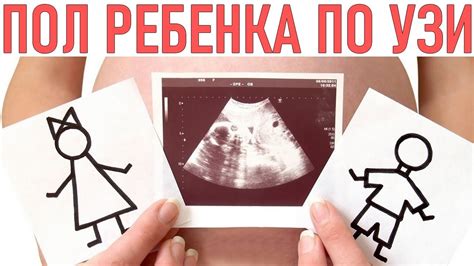 Зависимость от времени сексуального контакта в определении пола ребенка