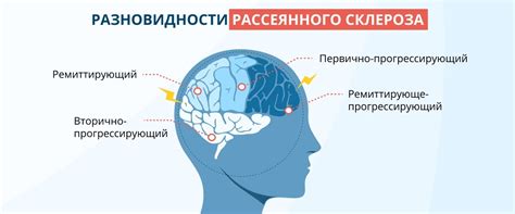 Загар и возникновение рассеянного склероза: научное объяснение