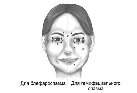 Закатывание глаз при сонливости