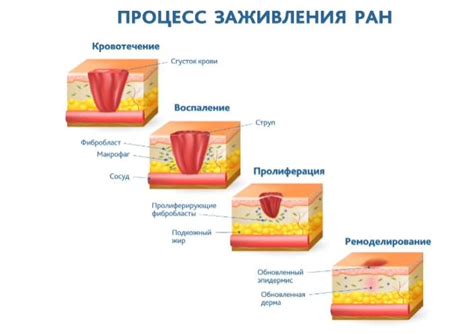 Замедленное заживление ран и ссадин