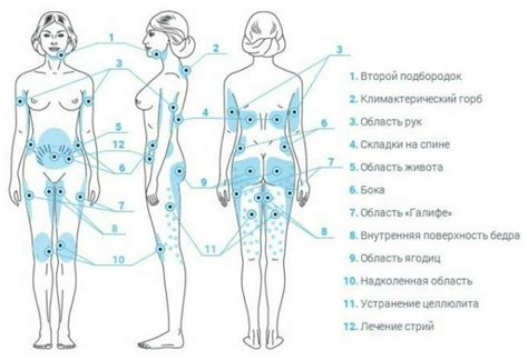 Запуск миостимулятора