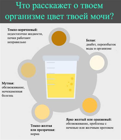 Затемнение мочи как симптом