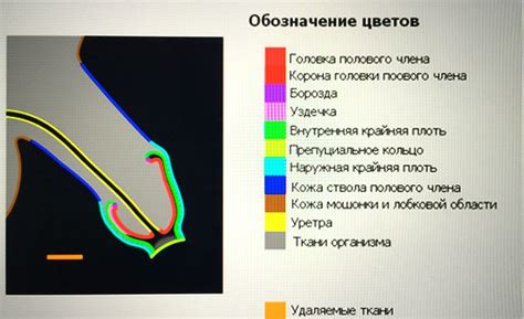 Зачем нужно регулярное обрезание крыльев