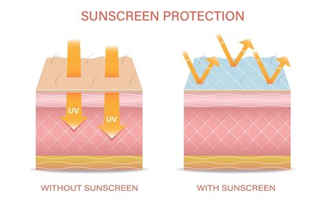 Защита кожи от ультрафиолетового излучения