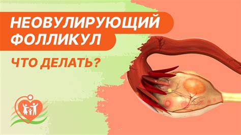 Защита организма: сохранность фолликула при овуляции