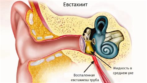 Звук треска и шум: возможные причины и варианты устранения проблемы