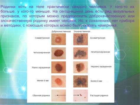 Знаки и методы диагностики злокачественных родинок