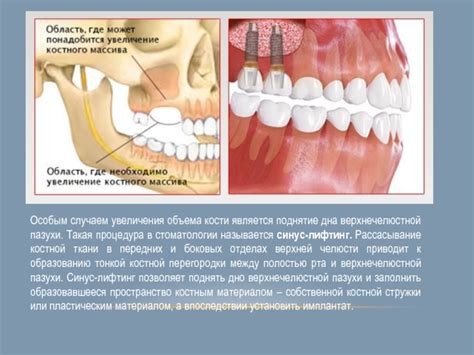 Значение верхнечелюстной кости в эстетической стоматологии