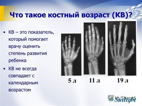 Значение рентгенографии для определения костного возраста