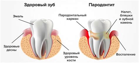 Зубной процесс и зуд десен