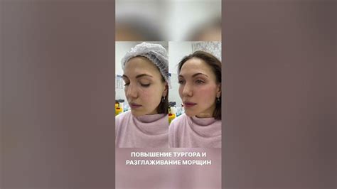 Избавляемся от помех и улучшаем качество изображения