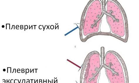 Избегайте вредных привычек для здоровья легких