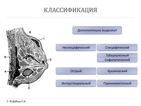 Избегайте мастита