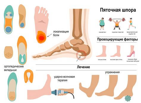 Избегайте перегрузки стопы, чтобы предотвратить образование шпоры на пятке