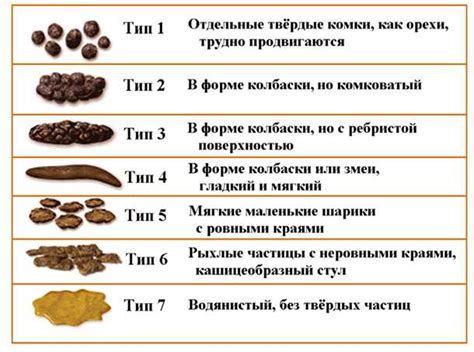 Изменение консистенции кала