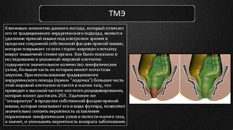 Изменение хирургического подхода