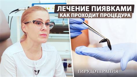 Изучение эффективности лечения пиявками