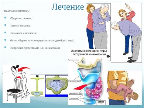 Инородные вещества в дыхательных путях