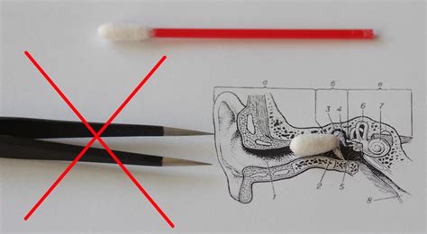Инструкция по заклеиванию уха безопасно и эффективно