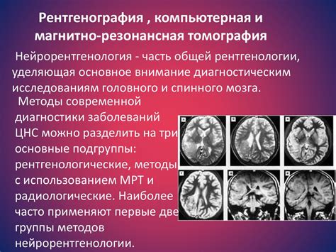 Инструментальные методы диагностики в неврологии: прецизионные методы